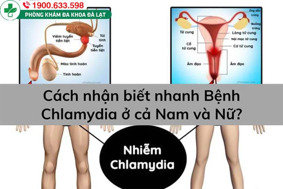 Hình ảnh minh họa